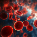 Understanding Leukemia: A Comprehensive Guide to Prevention, Treatment, and Support