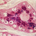 The Most Common Types of Cancer Worldwide