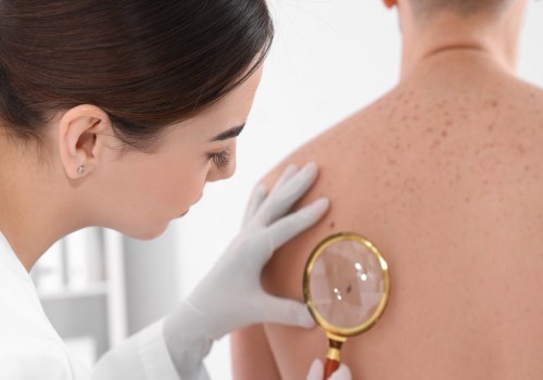 Early Warning Signs of Cancer: Know the Symptoms and How to Protect Yourself