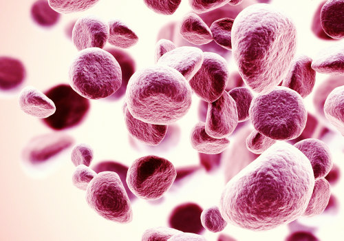 Understanding Multiple Myeloma: What You Need to Know